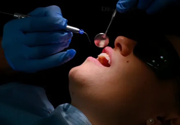 Consultația stomatologică este necesară pentru diagnosticul candidozei