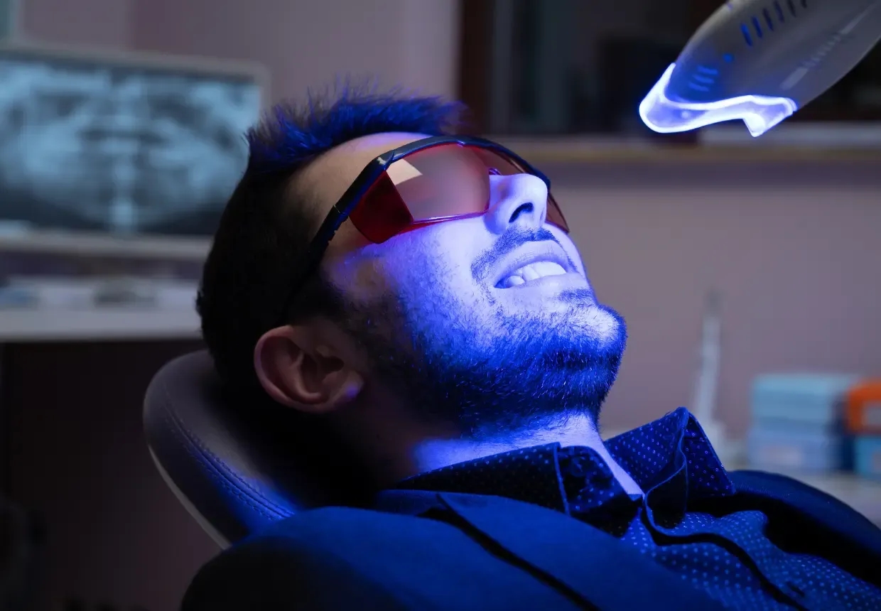 Cum să menții rezultatele după ședința de albire dentară.