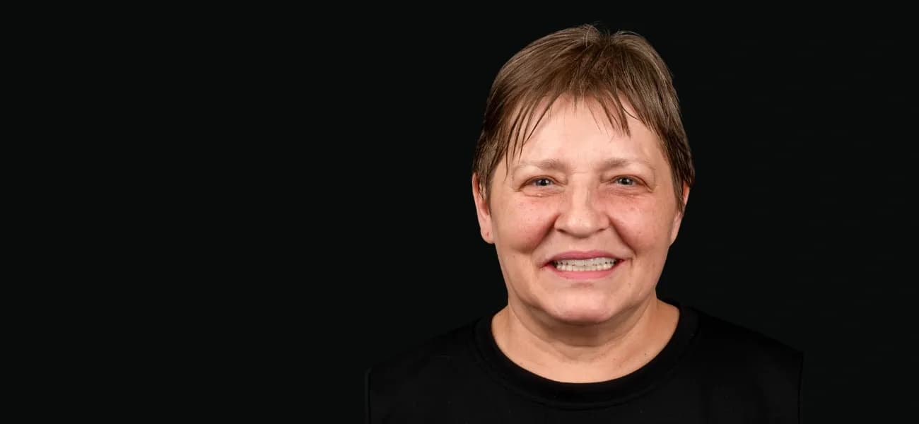 Reabilitare orala completa cu dinti ficsi pe implanturi All-on-4