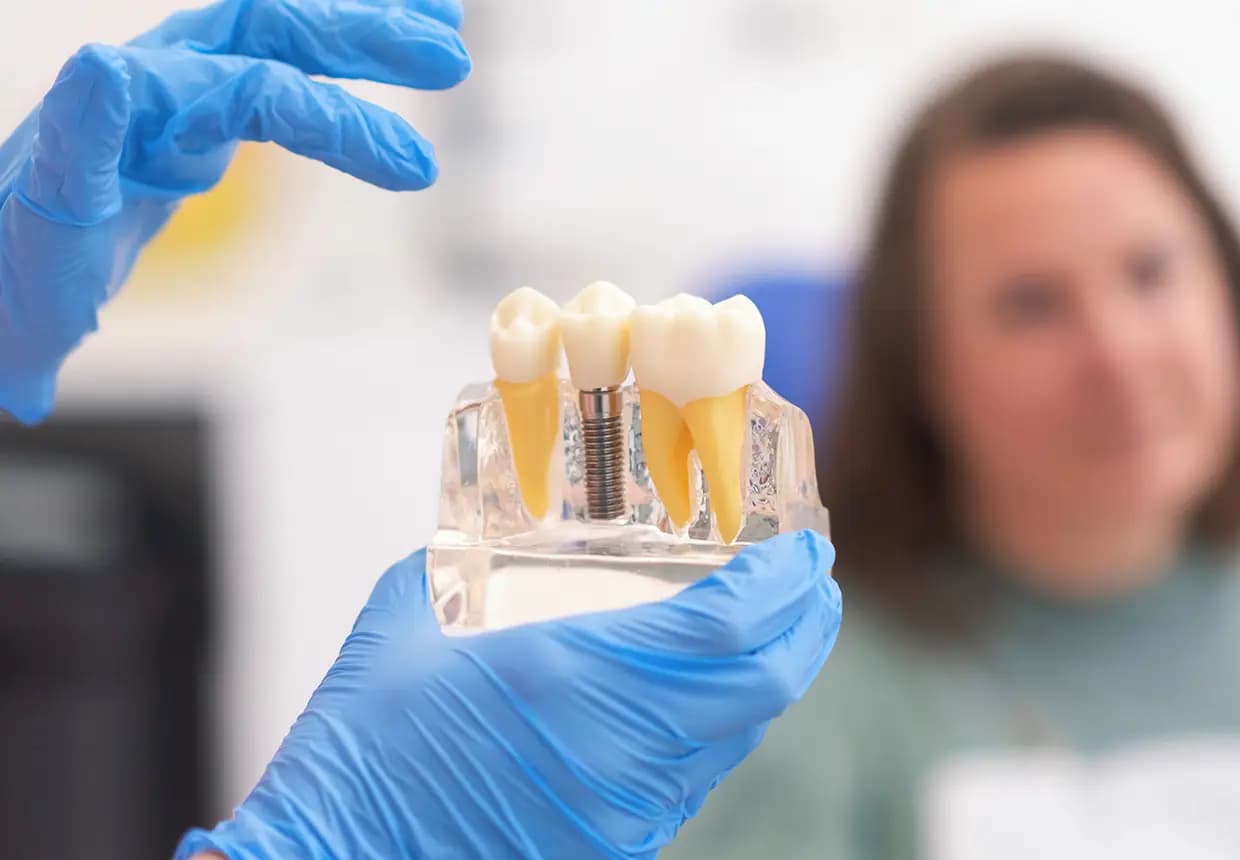 Medicul stomatolog arata pacientului un implant dentar