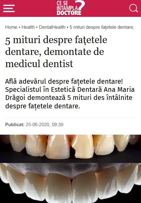 DENT ESTET
