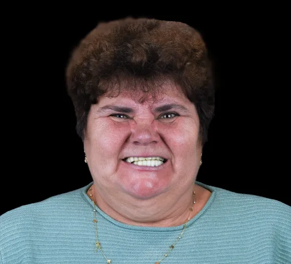 dinti-ficsi-pe-4-implanturi