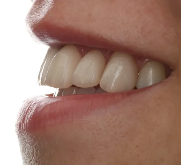 ghid-chirurgical-pentru-implant
