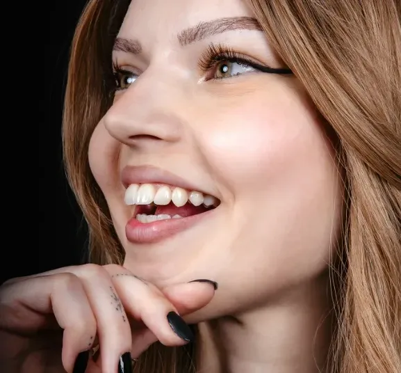 Zambet cu fatete dentare