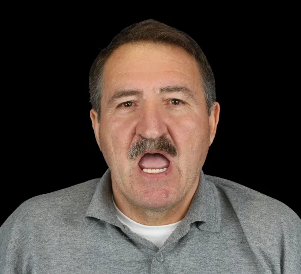 planificare tratament implanturi all-on-4 neodent neoarch