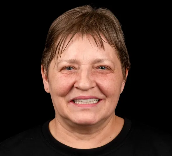 zambet-dupa-all-on-4-bucuresti