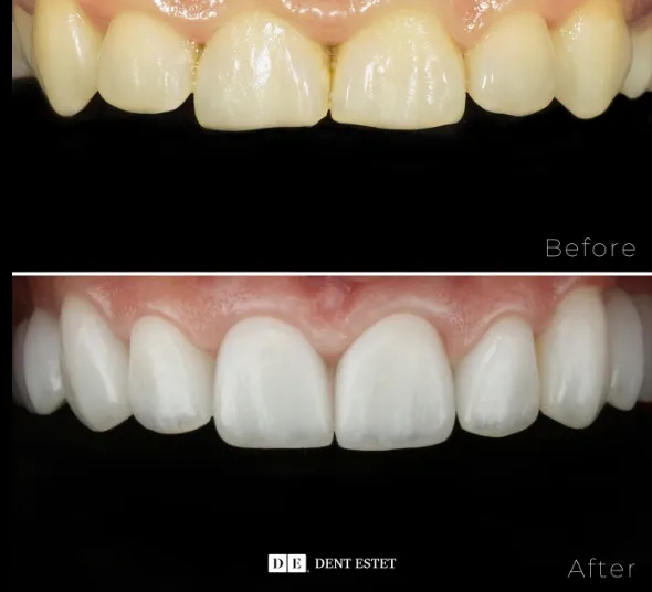 Pacienta fatete dentare