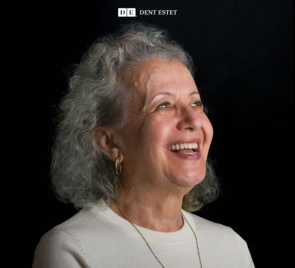 lucrare-provizorie-fixa-24h-neodent-neoarch