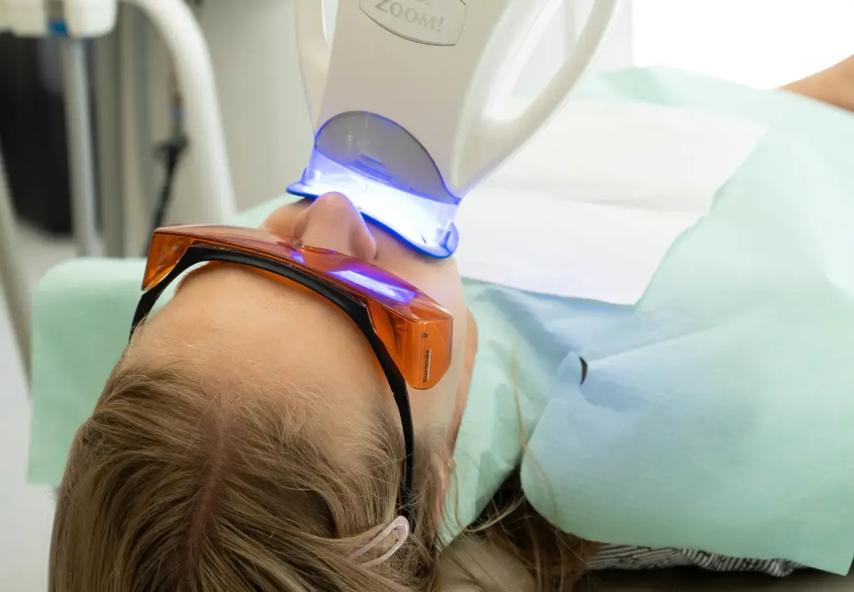 Ședință de albire dentară premium cu lampa LED