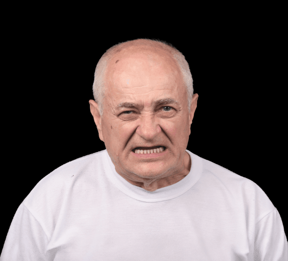 Pacientul Gheorghe G. înainte de tratamentul cu implant dentar Straumann® Pro Arch