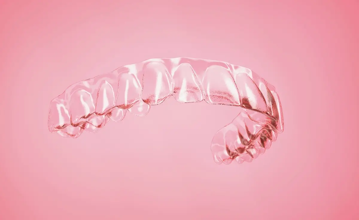 Tipuri de aparat dentar invizibil
