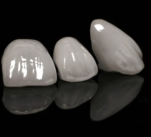 Fațete dentare ceramice.