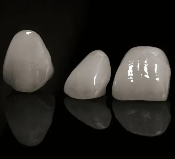 Fațete dentare ceramice