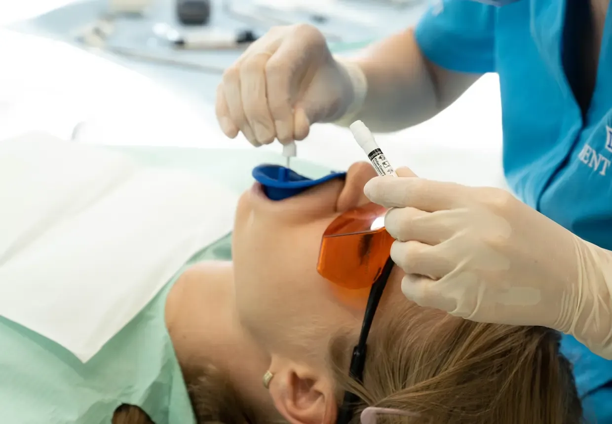 Aplicare gel albire dentară – pacienta înainte de albire dentară