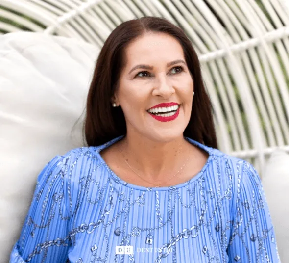 Pacienta zambind - rezultat dupa tratament cu implant dentar All-on-4