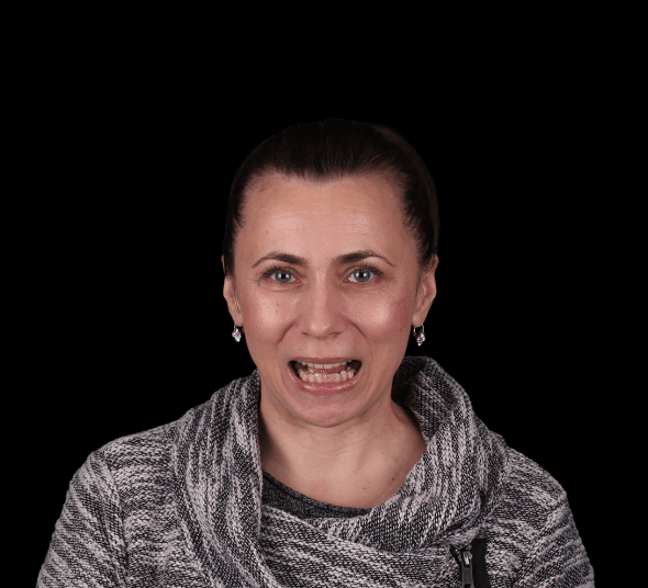 Pacientă înainte de tratamentul cu fațete dentare EMAX și coroane premium din zirconiu