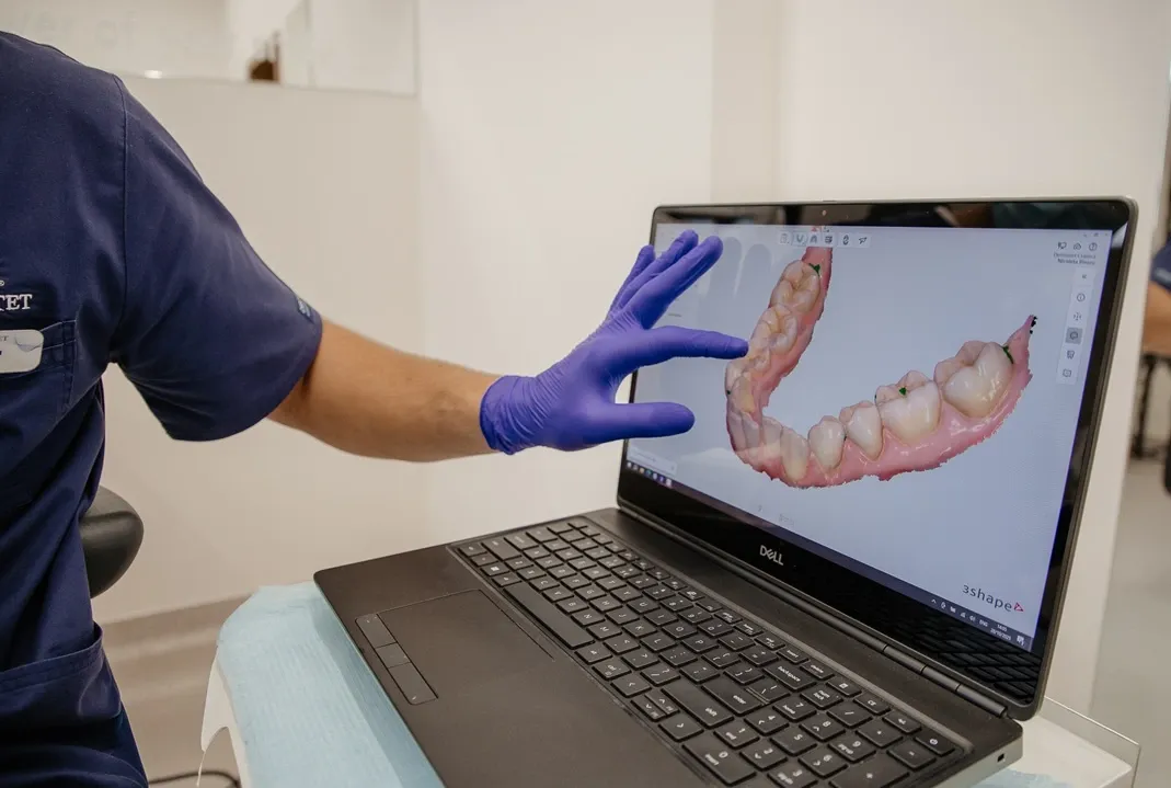 Medic care realizeaza amprenta dentara digitala in cabinet